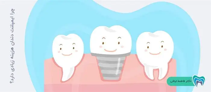 چرا ایمپلنت دندان هزینه زیادی دارد؟