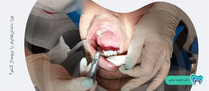 آیا بروساژ دندان توصیه می شود؟