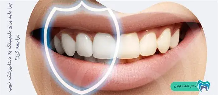 دلیل اهمیت مراجعه به یک متخصص خوب برای بلیچینگ دندان چیست؟