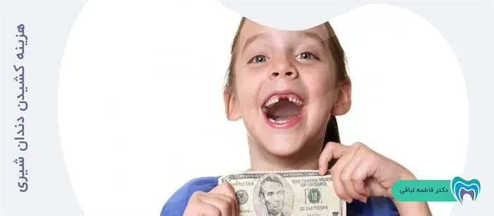 هزینه کشیدن دندان شیری کودکان چقدر است؟