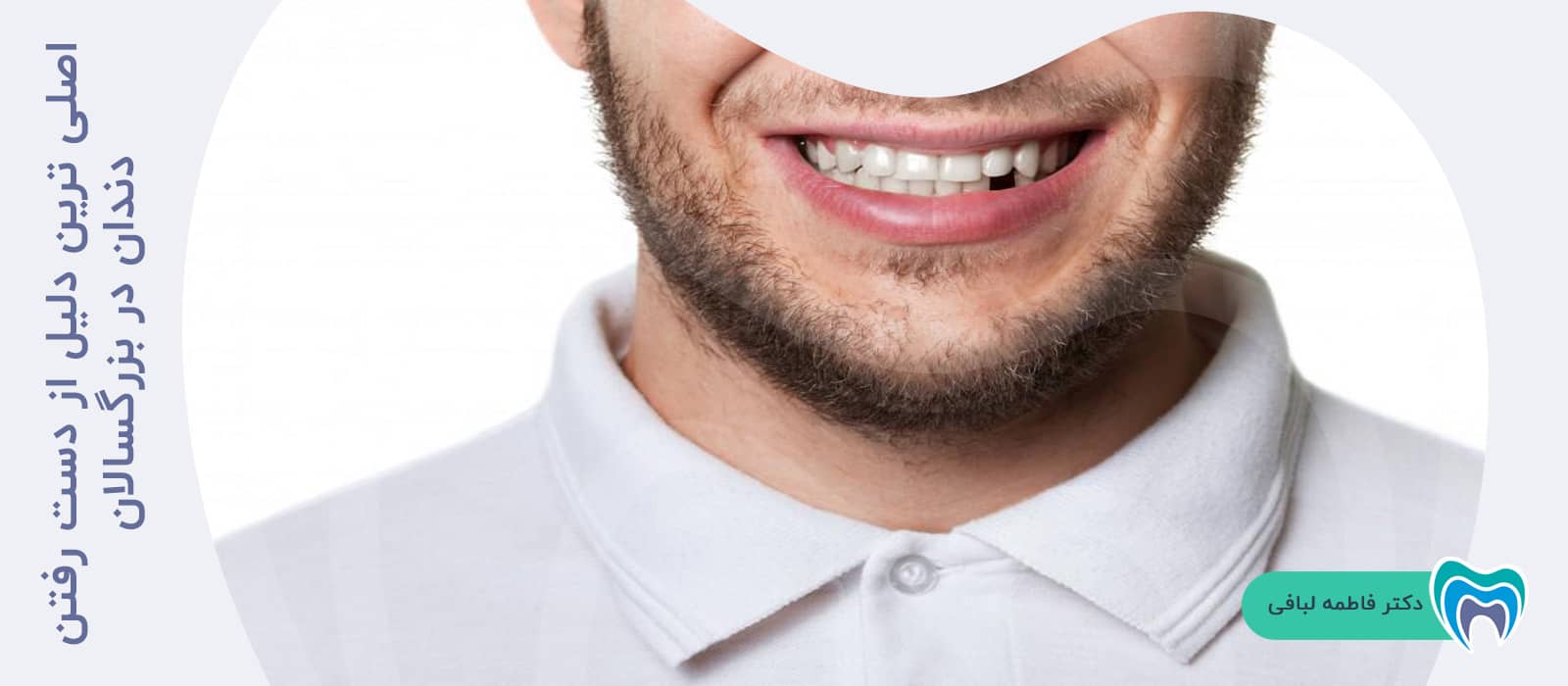 اصلی ترین دلیل از دست رفتن دندان در بزرگسالان